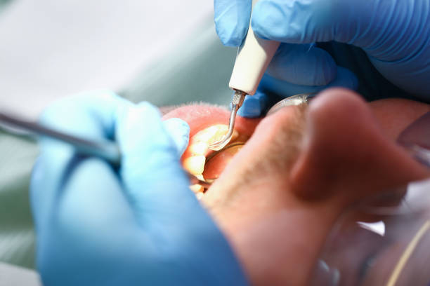 Best Emergency Dental Care for Broken or Chipped Teeth in Hurstbourne, KY